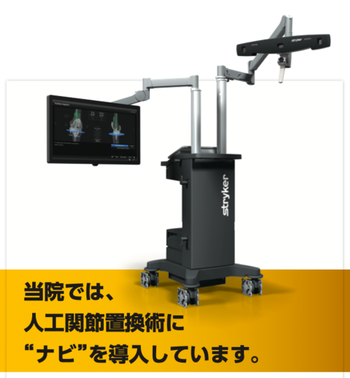 当院での人工関節置換術に「ナビ」を導入して手術をしています